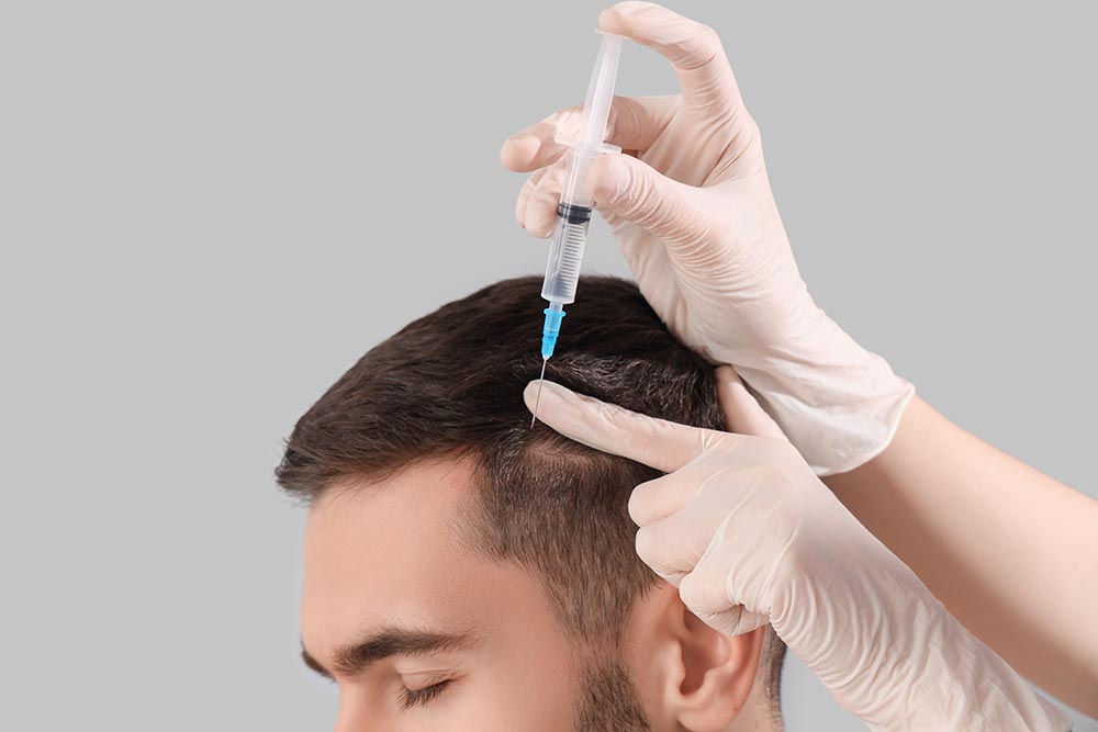 When Can You Exercise After a Hair Transplant?