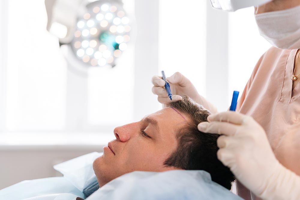 How Are Hair Transplant Prices Determined?